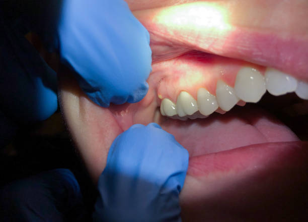 Best Weekend Emergency Dentist in Davison, MI