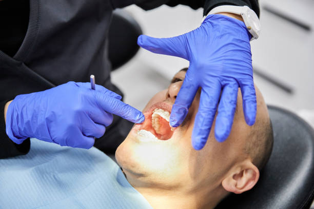 Best Emergency Treatment for Dental Infections or Abscesses in Davison, MI